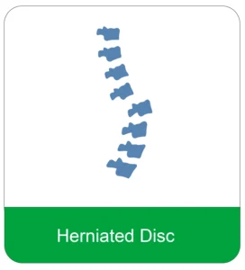 herniated 1